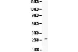 Western blot analysis of CNTF expression in MCF-7 whole cell lysates (lane 1). (CNTF antibody  (AA 12-200))