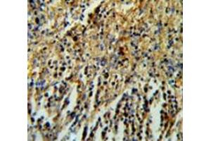 Immunohistochemistry analysis in human spleen tissue (Formalin-fixed, Paraffin-embedded) using PHTNS  Antibody  (N-term), followed by peroxidase conjugation of the secondary antibody and DAB staining. (KIAA1949 antibody  (N-Term))