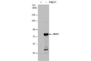 WB Image MLH1 antibody detects MLH1 protein by western blot analysis. (MLH1 antibody)