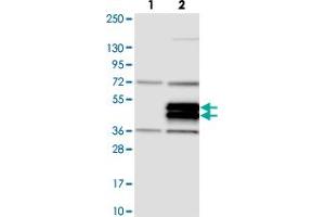 Western blot analysis of Lane 1: Negative control (vector only transfected HEK293T lysate). (TRIML2 antibody)