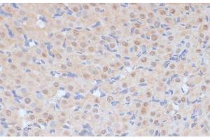 Immunohistochemistry of paraffin-embedded Rat ovary using CDK9 Polyclonal Antibody at dilution of 1:100 (40x lens). (CDK9 antibody)