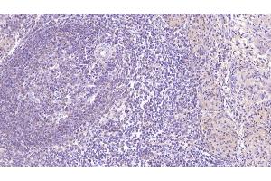 Detection of SIGLEC7 in Human Spleen Tissue using Monoclonal Antibody to Sialic Acid Binding Ig Like Lectin 7 (SIGLEC7) (SIGLEC7 antibody  (AA 18-353))