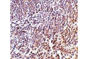 Immunohistochemistry (IHC) image for anti-Lymphocyte Antigen 86 (LY86) (C-Term) antibody (ABIN1030512) (LY86 antibody  (C-Term))