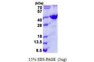 Figure annotation denotes ug of protein loaded and % gel used. (FRZB Protein)