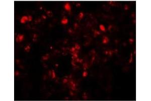 Immunofluorescence of Translin in human lung tissue with Translin antibody at 20 µg/ml. (Translin antibody  (C-Term))