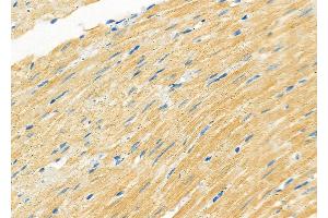 ABIN6263312 and ABIN6266806 at 1/100 staining Rat heart tissue by IHC-P.