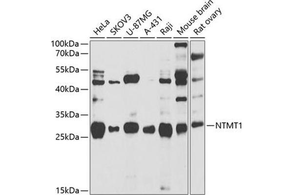 METTL11A 抗体  (AA 1-223)