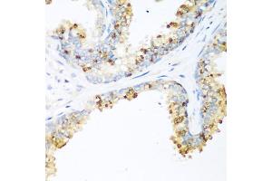 Immunohistochemistry of paraffin-embedded human prostate using LRP5 antibody (ABIN5974915) at dilution of 1/200 (40x lens). (LRP5 antibody)