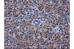 Immunohistochemical staining of paraffin-embedded Human pancreas tissue using anti-DSTN mouse monoclonal antibody.