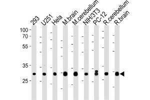 Western Blotting (WB) image for anti-Phosphatidylinositol Transfer Protein, alpha (PITPNA) antibody (ABIN3004594) (PITPNA antibody)