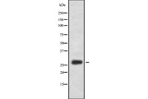 Western blot analysis of FA58A expression in HEK293 cells ,The lane on the left is treated with the antigen-specific peptide.