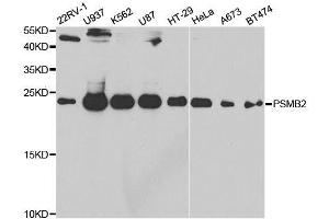 Western blot analysis of extracts of various cell lines, using PSMB2 antibody. (PSMB2 antibody  (AA 1-201))