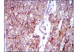 Flow Cytometry (FACS) image for anti-Activated Leukocyte Cell Adhesion Molecule (ALCAM) (AA 48-216) antibody (ABIN1846221)