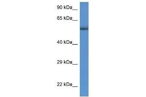 Western Blot showing GBA antibody used at a concentration of 1 ug/ml against MDA-MB-435S Cell Lysate (GBA antibody  (C-Term))