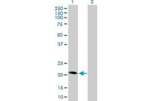 Western Blot analysis of MCAT expression in transfected 293T cell line by MCAT MaxPab polyclonal antibody.