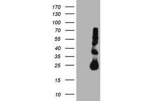 HEK293T cells were transfected with the pCMV6-ENTRY control (Left lane) or pCMV6-ENTRY TIMP2 (Right lane) cDNA for 48 hrs and lysed. (TIMP2 antibody)