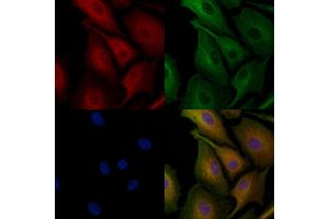 ABIN6259672 and ABIN6278181 staining  cells by IF/ICC. (ABAT antibody  (Internal Region))