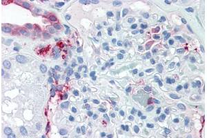 Anti-SLC39A14 antibody  ABIN1049336 IHC staining of human kidney. (SLC39A14 antibody  (Internal Region))