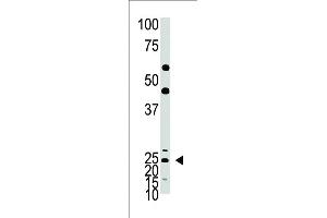 The anti-Hash1 Pab  is used in Western blot to detect Hash1 in mouse lung tissue lysate. (ASCL1 antibody  (C-Term))