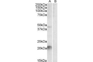 ABIN2563590 staining (2µg/ml) of Mouse Liver lysate (35µg protein in RIPA buffer) with (B) and without (A) blocking with the immunising peptide.