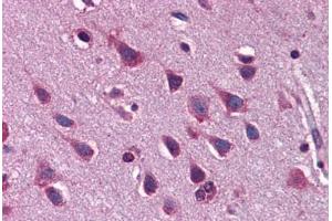 Human Brain, Cortex: Formalin-Fixed, Paraffin-Embedded (FFPE) (ZEB2 antibody  (AA 30-79))