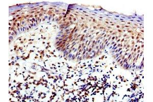 IHC image of ABIN7175826 diluted at 1:400 and staining in paraffin-embedded human tonsil tissue performed on a Leica BondTM system. (WASP antibody  (AA 145-265))