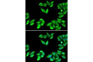 Immunofluorescence analysis of MCF-7 cells using RPS14 antibody.