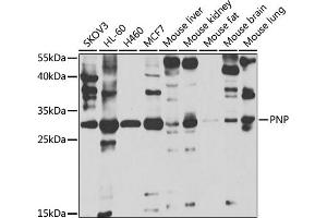 Western blot analysis of extracts of various cell lines, using PNP antibody  at 1:1000 dilution. (PNP antibody  (AA 1-289))