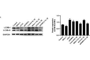 DNM1L deficiency reduces ROS production and autophagy in FLS. (GAPDH antibody)