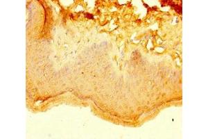 Immunohistochemistry of paraffin-embedded human skin tissue using ABIN7157404 at dilution of 1:100 (KRT4 antibody  (AA 1-200))