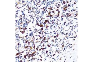 Immunohistochemistry of paraffin-embedded human tonsil using RPN1 antibody. (RPN1 antibody  (AA 20-280))