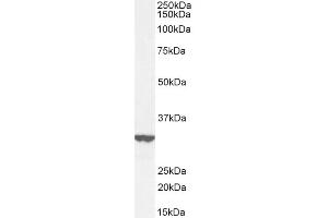 ITM2B antibody  (Internal Region)