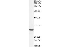 ABIN570955 (0. (ITM2B antibody  (Internal Region))