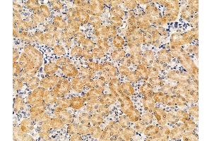 ABIN7094609 and ABIN7098659 at 1/100 staining Mouse kidney tissue by IHC-P.