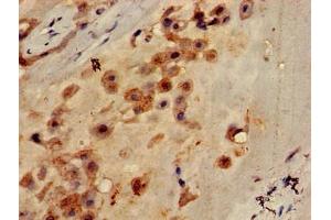Immunohistochemistry of paraffin-embedded human placenta tissue using ABIN7146093 at dilution of 1:100