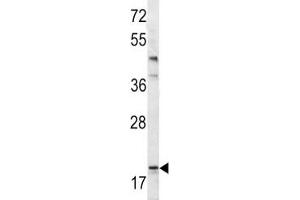 Western Blotting (WB) image for anti-BCL2-Associated Agonist of Cell Death (BAD) (AA 92-127) antibody (ABIN3030135)