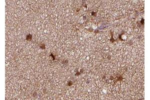 ABIN6266780 at 1/100 staining human brain tissue sections by IHC-P. (TNFRSF6B antibody)