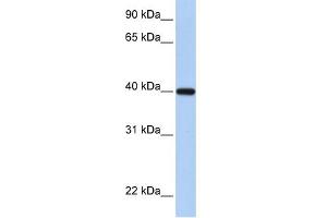 WB Suggested Anti-RDH11 Antibody Titration:  0. (RDH11 antibody  (C-Term))