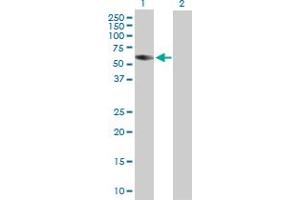 Western Blot analysis of CORO2B expression in transfected 293T cell line by CORO2B MaxPab polyclonal antibody. (CORO2B antibody  (AA 1-475))