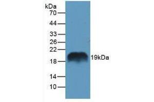 Western blot analysis of Rat Pancreas Tissue. (REG1A antibody  (AA 10-165))