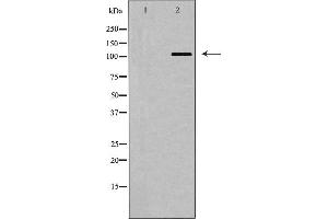 Western blot analysis of BUB1 expression in COLO205 cells,The lane on the left is treated with the antigen-specific peptide. (BUB1 antibody  (Internal Region))