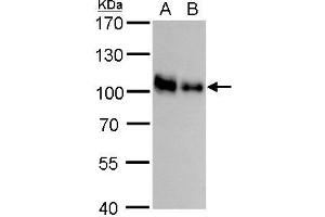 WB Image CD44 antibody detects CD44 protein by western blot analysis.