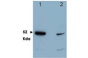 Western blot using PDCD4 polyclonal antibody  shows detection of a band ~52 kDa in size corresponding to PDCD4 (arrowhead). (PDCD4 antibody  (C-Term))