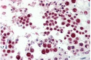 Human Testis (formalin-fixed, paraffin-embedded) stained with EZH2 antibody ABIN337251 at 5 ug/ml followed by biotinylated goat anti-rabbit IgG secondary antibody ABIN481713, alkaline phosphatase-streptavidin and chromogen. (EZH2 antibody  (Internal Region))