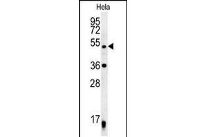 Western blot analysis in Hela cell line lysates (35ug/lane). (DDX47 antibody  (C-Term))
