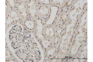 Immunoperoxidase of monoclonal antibody to MSI1 on formalin-fixed paraffin-embedded human kidney.