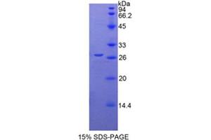 SDS-PAGE analysis of Mouse CYR61 Protein. (CYR61 Protein)