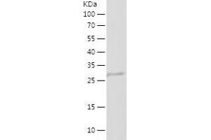 Western Blotting (WB) image for Angiogenin (ANG) (AA 25-147) protein (His-IF2DI Tag) (ABIN7282808) (ANG Protein (AA 25-147) (His-IF2DI Tag))