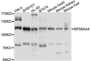 Western blot analysis of extracts of various cell lines, using RPS6KA4 antibody (ABIN6003828) at 1/1000 dilution. (MSK2 antibody)