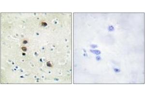 Immunohistochemistry analysis of paraffin-embedded human brain, using PKD1/PKC mu (Phospho-Ser205) Antibody. (PKC mu antibody  (pSer205))